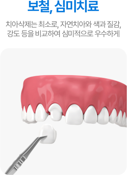 보철, 심미치료