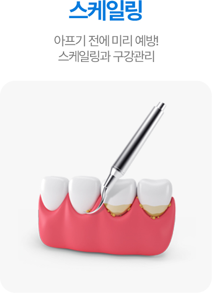 스케일링