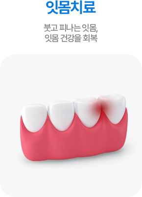 잇몸치료